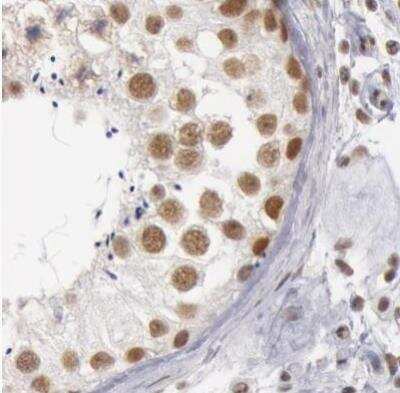 Immunohistochemistry-Paraffin: DGCR14 Antibody [NBP1-84258]