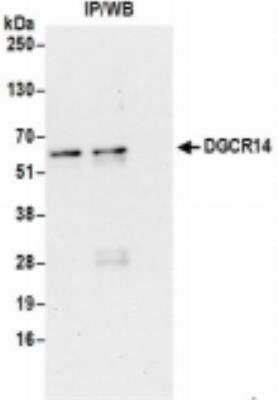Immunoprecipitation: DGCR14 Antibody [NBP2-36530]