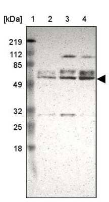 Western Blot: DGCR14 Antibody [NBP1-84257]