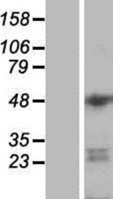 Western Blot: DGCR14 Overexpression Lysate [NBP2-06420]