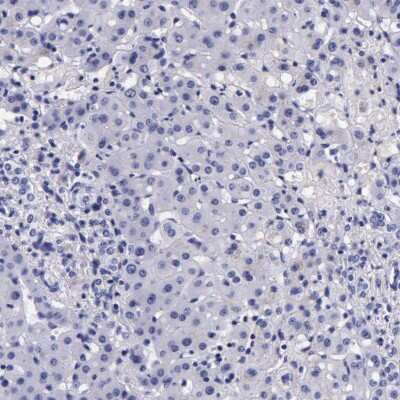 Immunohistochemistry-Paraffin: DGCR2 Antibody [NBP1-84255]