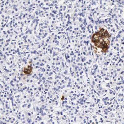 Immunohistochemistry-Paraffin: DGCR2 Antibody [NBP1-84255]