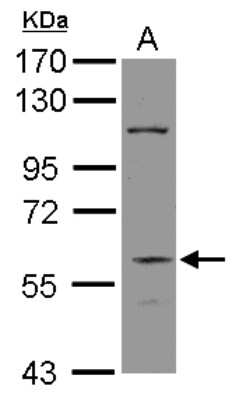 Western Blot: DGCR2 Antibody [NBP2-16155]