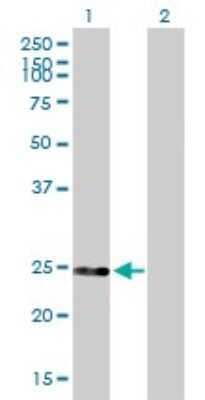 Western Blot: DGCR6 Antibody [H00008214-B01P]