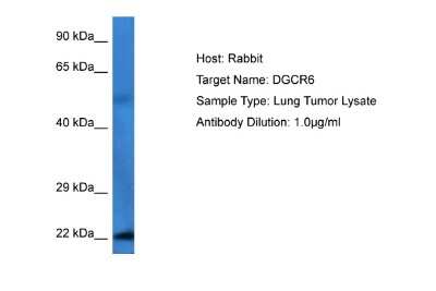 Western Blot: DGCR6 Antibody [NBP2-84003]