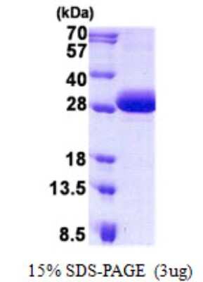 SDS-PAGE: Recombinant Human DGCR6 His Protein [NBP2-23002]