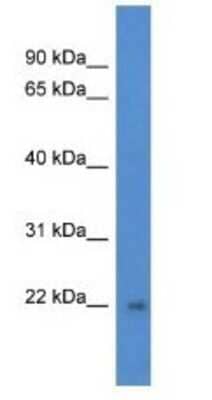 Western Blot: DGCR6L Antibody [NBP1-79875]