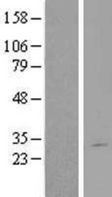 Western Blot: DGCR6L Overexpression Lysate [NBL1-09849]