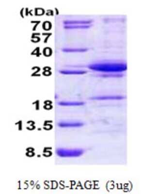 SDS-PAGE: Recombinant Human DGCR6L His Protein [NBP2-23003]