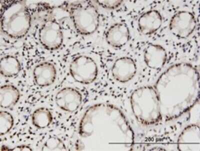 Immunohistochemistry-Paraffin: DGCR8 Antibody (4G3) [H00054487-M01]