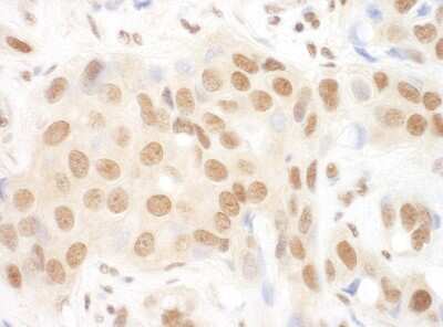 Immunohistochemistry-Paraffin: DGCR8 Antibody [NBP1-30115]