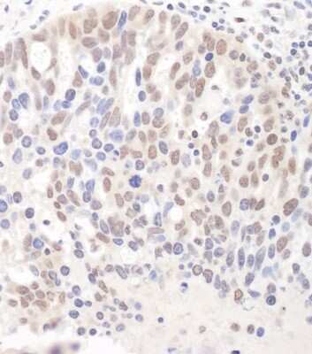 Immunohistochemistry: DGCR8 Antibody [NBP1-30116]