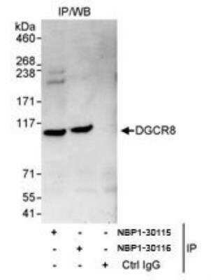 Immunoprecipitation: DGCR8 Antibody [NBP1-30116]