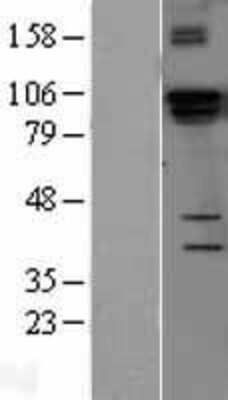 Western Blot: DGCR8 Overexpression Lysate [NBL1-09850]