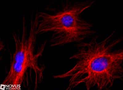 Immunocytochemistry/ Immunofluorescence: DGCR8 knockout MEF cells [NBP2-25171]
