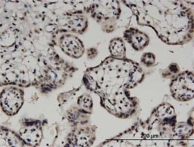 Immunohistochemistry-Paraffin: DGK-alpha Antibody (2B7) [H00001606-M02]