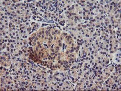 Immunohistochemistry: DGK-alpha Antibody (OTI4A11) - Azide and BSA Free [NBP2-70547]
