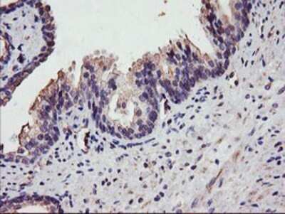 Immunohistochemistry: DGK-alpha Antibody (OTI4A11) - Azide and BSA Free [NBP2-70547]