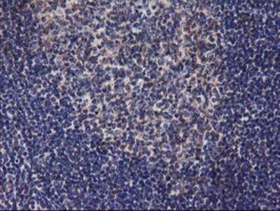 Immunohistochemistry: DGK-alpha Antibody (OTI4A11) - Azide and BSA Free [NBP2-70547]