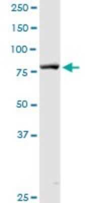 Western Blot: DGK-alpha Antibody [H00001606-D01P]