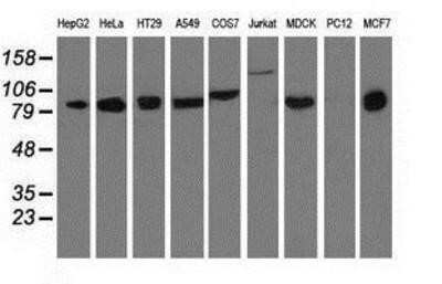 Western Blot: DGK-beta Antibody (OTI1F9)Azide and BSA Free [NBP2-70552]