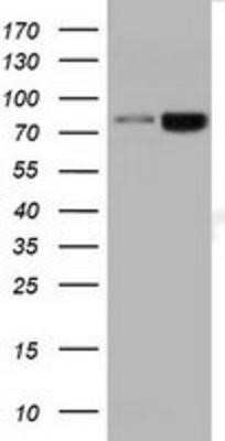 Western Blot: DGK-beta Antibody (OTI1F9)Azide and BSA Free [NBP2-70552]