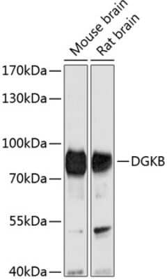 Western Blot: DGK-beta AntibodyAzide and BSA Free [NBP2-92028]