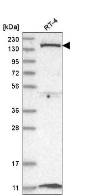 Western Blot: DGK-delta Antibody [NBP2-58630]