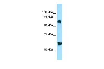 Western Blot: DGK-delta Antibody [NBP2-87266]