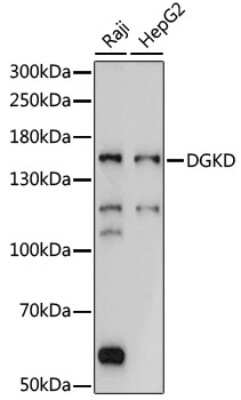 Western Blot: DGK-delta AntibodyAzide and BSA Free [NBP2-92207]