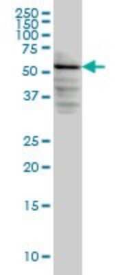 Western Blot: DGK-epsilon Antibody (7E1) [H00008526-M03]