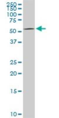 Western Blot: DGK-epsilon Antibody (7E1) [H00008526-M03]