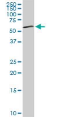Western Blot: DGK-epsilon Antibody (7E1) [H00008526-M03]