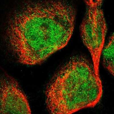 Immunocytochemistry/ Immunofluorescence: DGK-epsilon Antibody [NBP1-85315]