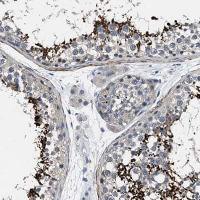 Immunohistochemistry-Paraffin: DGK-epsilon Antibody [NBP1-85315]