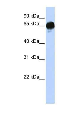 Western Blot: DGK-epsilon Antibody [NBP1-59067]