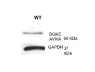 Western Blot: DGK-epsilon Antibody [NBP1-59067]