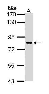 Western Blot: DGK-gamma Antibody [NBP1-33055]