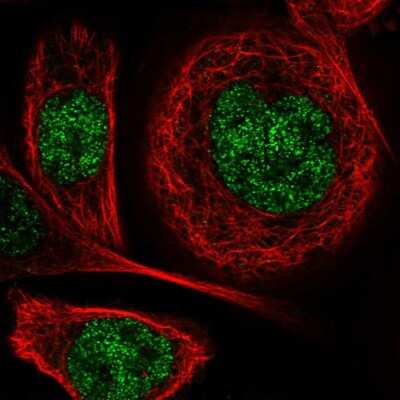 Immunocytochemistry/ Immunofluorescence: DGK-iota Antibody [NBP1-85227]