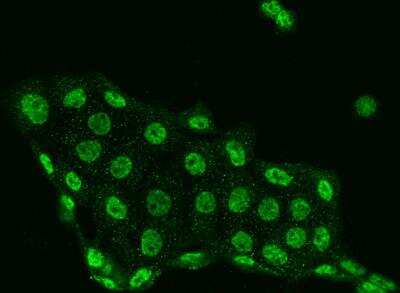 Immunocytochemistry/ Immunofluorescence: DGK-iota Antibody [NBP3-06558]