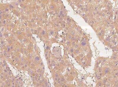 Immunohistochemistry-Paraffin: DGK-iota Antibody [NBP3-06558]
