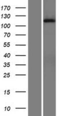 Western Blot: DGK-iota Overexpression Lysate [NBP2-10536]