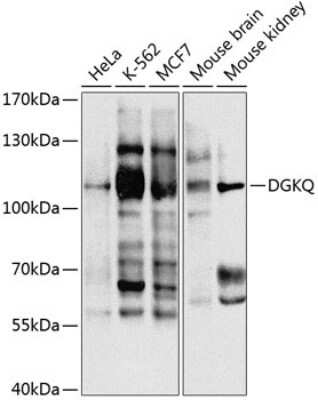 Western Blot: DGK-theta AntibodyBSA Free [NBP2-92780]