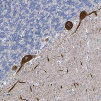 Immunohistochemistry-Paraffin: DGK-zeta Antibody [NBP2-13918]