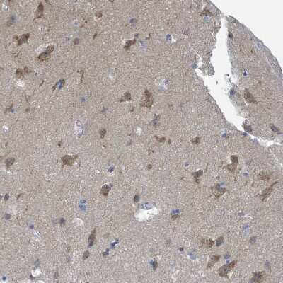 Immunohistochemistry-Paraffin: DGK-zeta Antibody [NBP2-13918]
