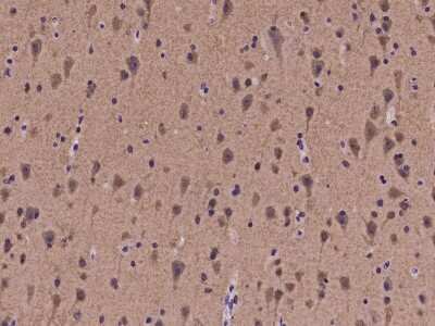 Immunohistochemistry-Paraffin: DGK-zeta Antibody [NBP2-97260]