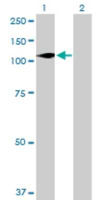 Western Blot: DGK-zeta Antibody [H00008525-B01P]