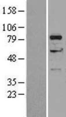 Western Blot: DGK-alpha Overexpression Lysate [NBL1-09851]