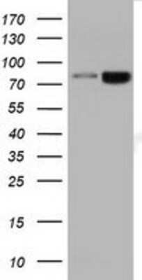 Western Blot: DGK-beta Antibody (OTI1F9) [NBP2-02733]