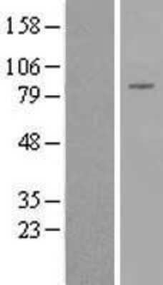 Western Blot: DGK-beta Overexpression Lysate [NBL1-09853]